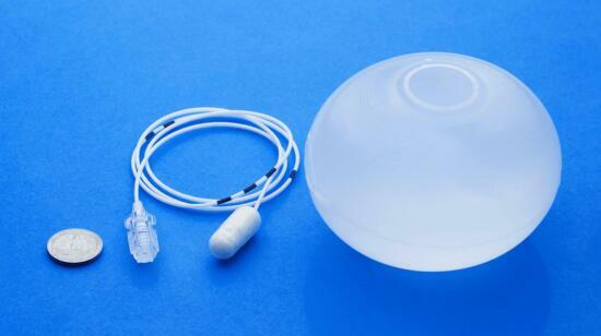 ​​​​​​​​​​​​Allurion Weight Loss Balloon