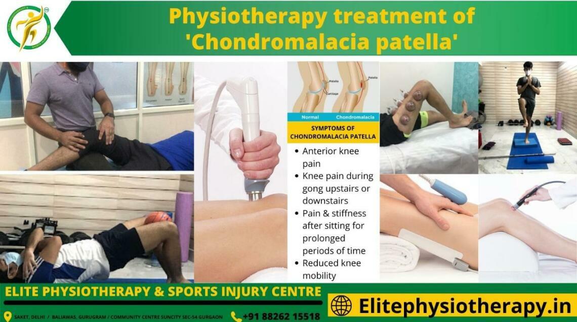 Physiotherapy Treatment of Chondromalacia Patella