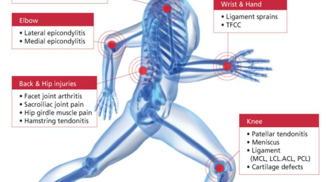 Understanding Prp (Platelet Rich Plasma)