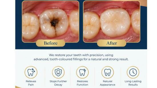 Don't Let a Deacyed Tooth Go Untreated