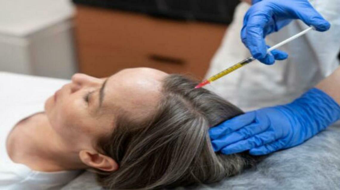 What Is Gfc Treatment and How Does It Help in Hair Regrowth