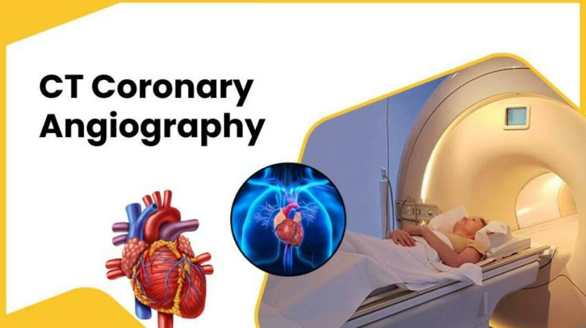 What Is Ct Coronary Angiography? Everything You Need to Know