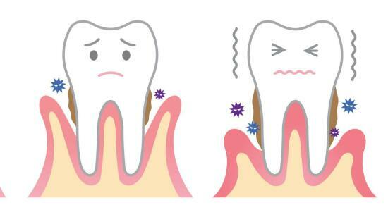 5 Ways Bad Gums Are Actually Affecting Your Entire Health