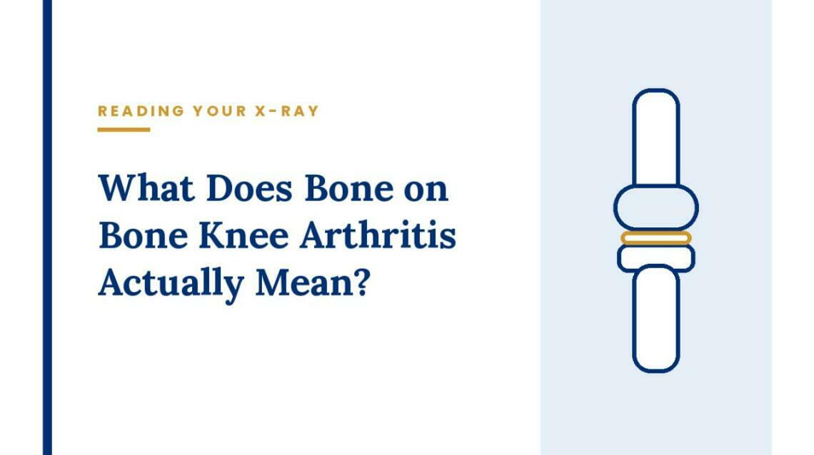 What Does Bone on Bone Knee Arthritis Actually Mean?