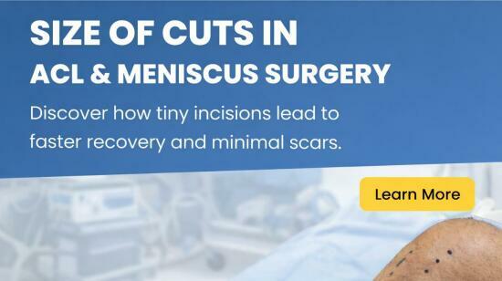 How Small Are the Cuts in Acl and Meniscus Surgery?