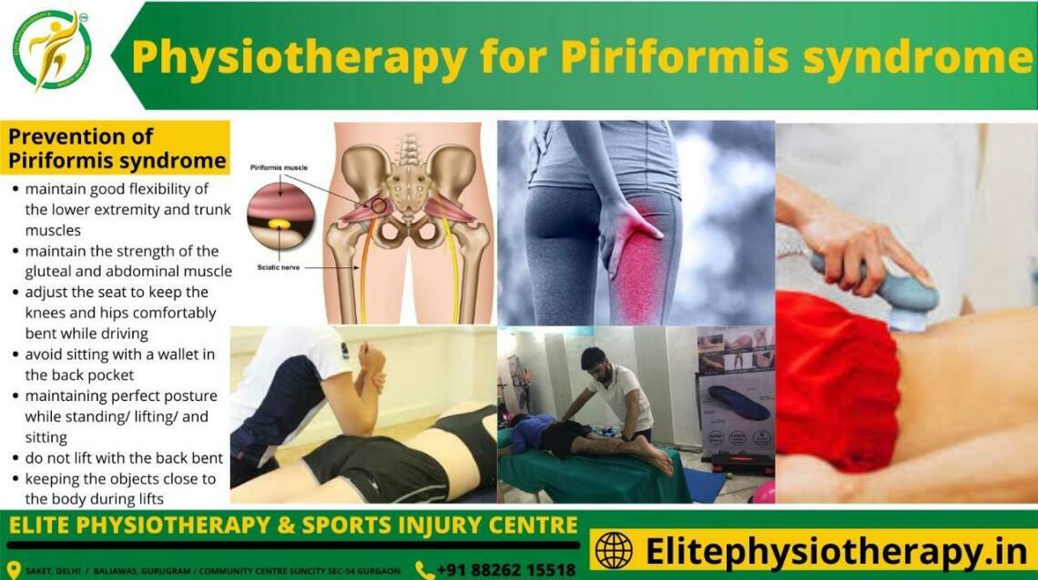 Physiotherapy for Piriformis Syndrome