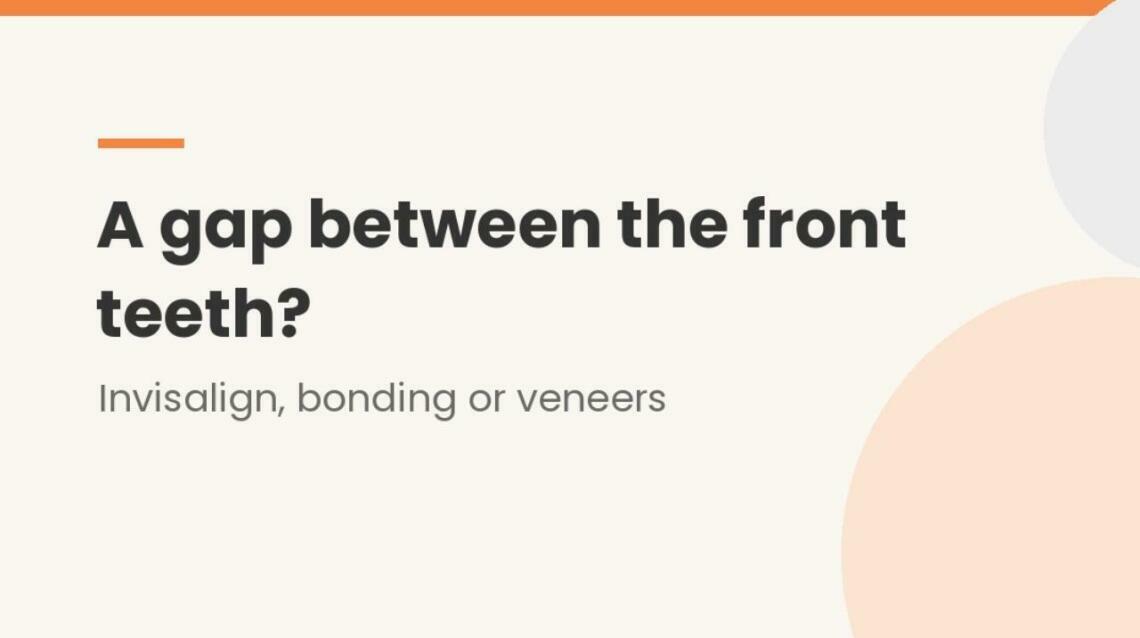 Gap Between Your Front Teeth? Invisalign, Bonding or Veneers