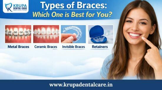Types of Braces: Which One Is Best for You? | Krupa Dental Care |