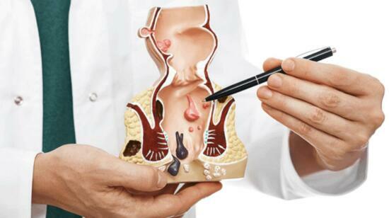 Laser vs Conventional Surgery for Haemorrhoids :  Which Option Is Right for You ?