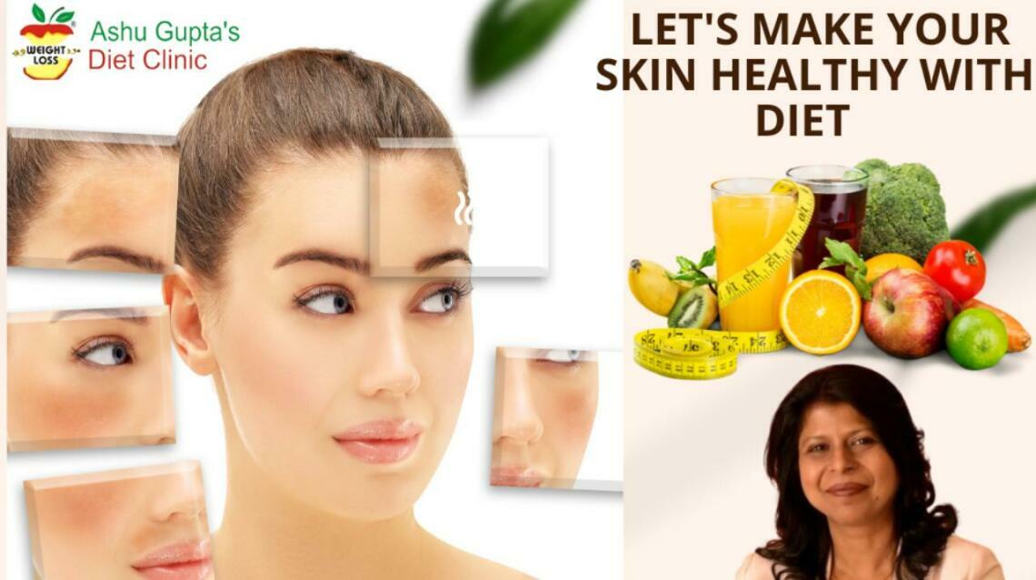 Diet for Pigmentation on Face What You Should It or Not