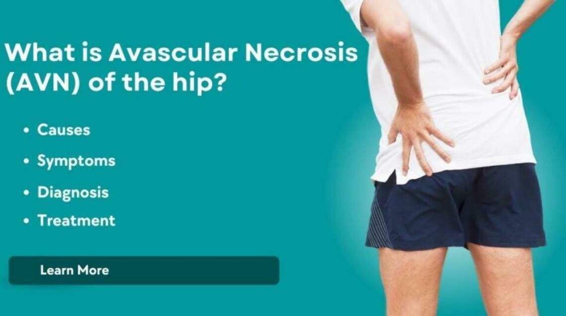 Avascular Necrosis of Hip Joint