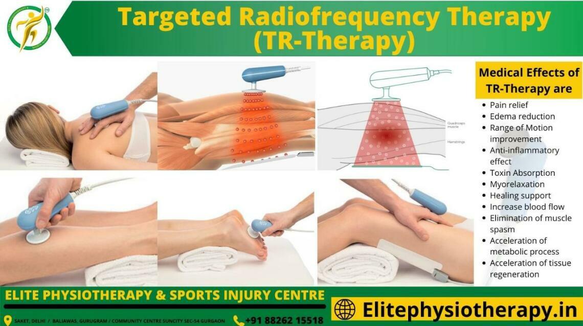 Targeted Radiofrequency Therapy (TrTherapy)