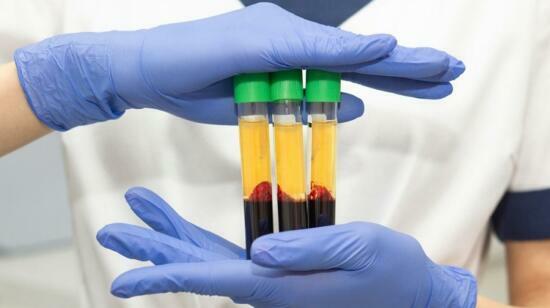 Prp in Sports Injuries