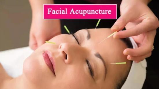 Cosmetic Acupuncture Is Very Effective For Adult Acne