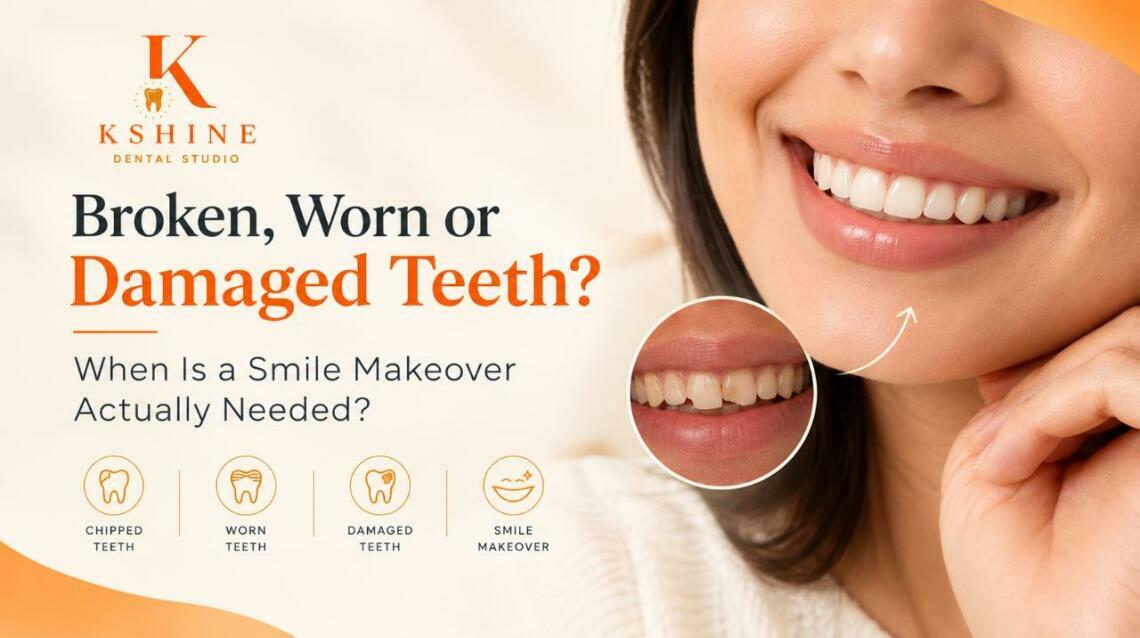 Broken, Worn or Damaged Teeth? When Is a Smile Makeover Actually Needed?