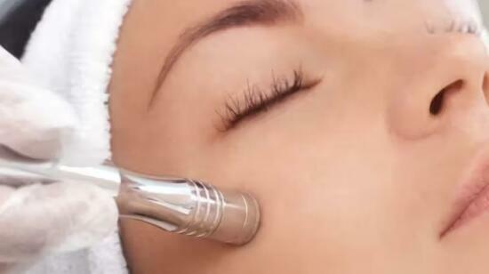 Microdermabrasion