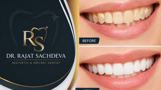 ​​​​Tooth Discoloration Treatment in Delhi –  Restore a Brighter, Healthier Smile