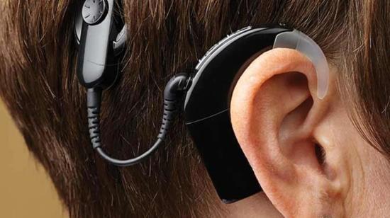 Recommended Accessories for Cochlear Implant Users