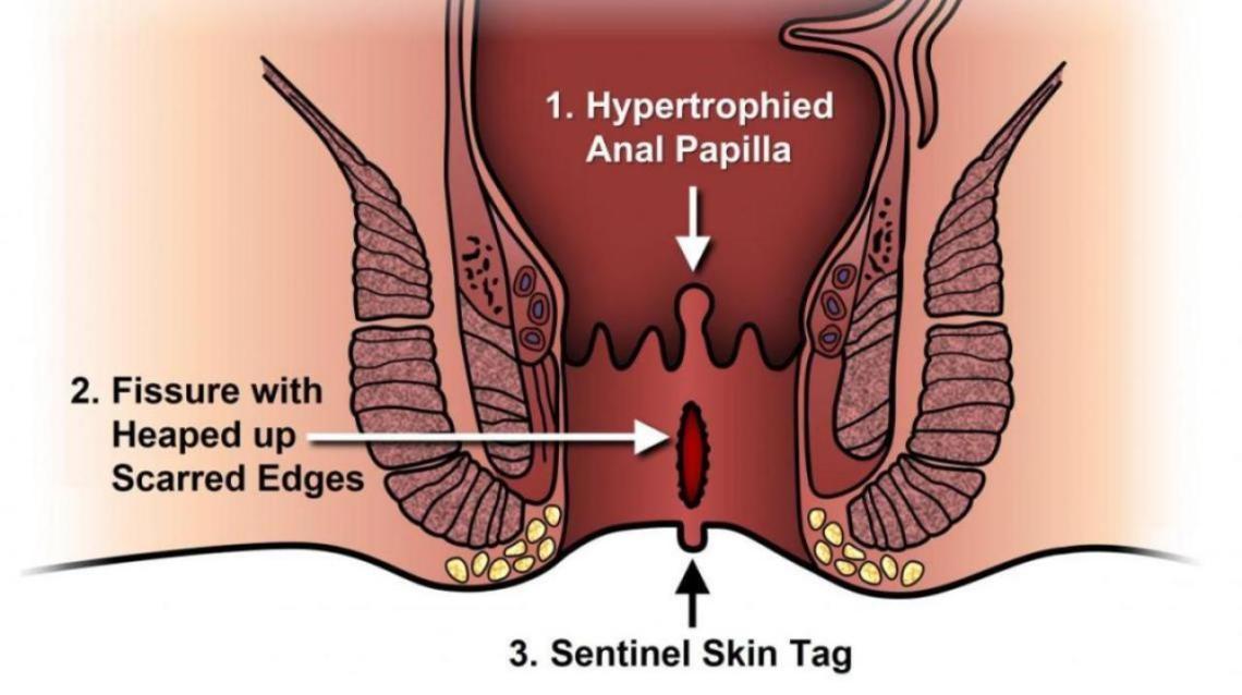 Anatomy Of Anal Sex