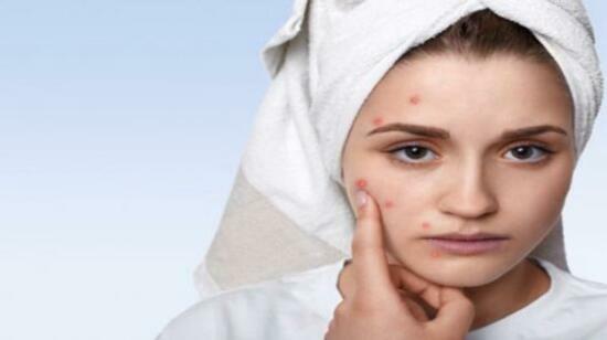Advanced Acne Scar Removal Treatments You Should Know
