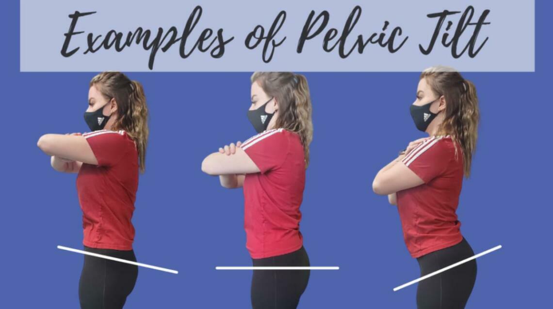 What Is Pelvic Tilt and Its Corrective Exercises