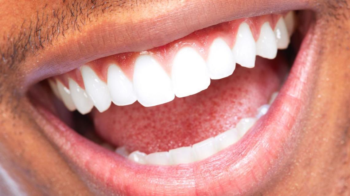 What Happens If Your Uvula Is Touching Your Tongue