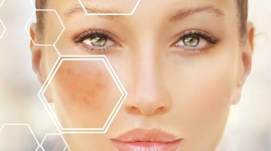 Most Effective Ingredients for Pigmentation:what Dermatologists Usually  Recommend