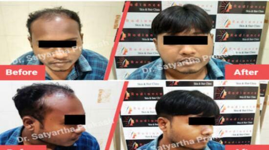 Which Is Better: Synthetic or Natural Hair Wigs