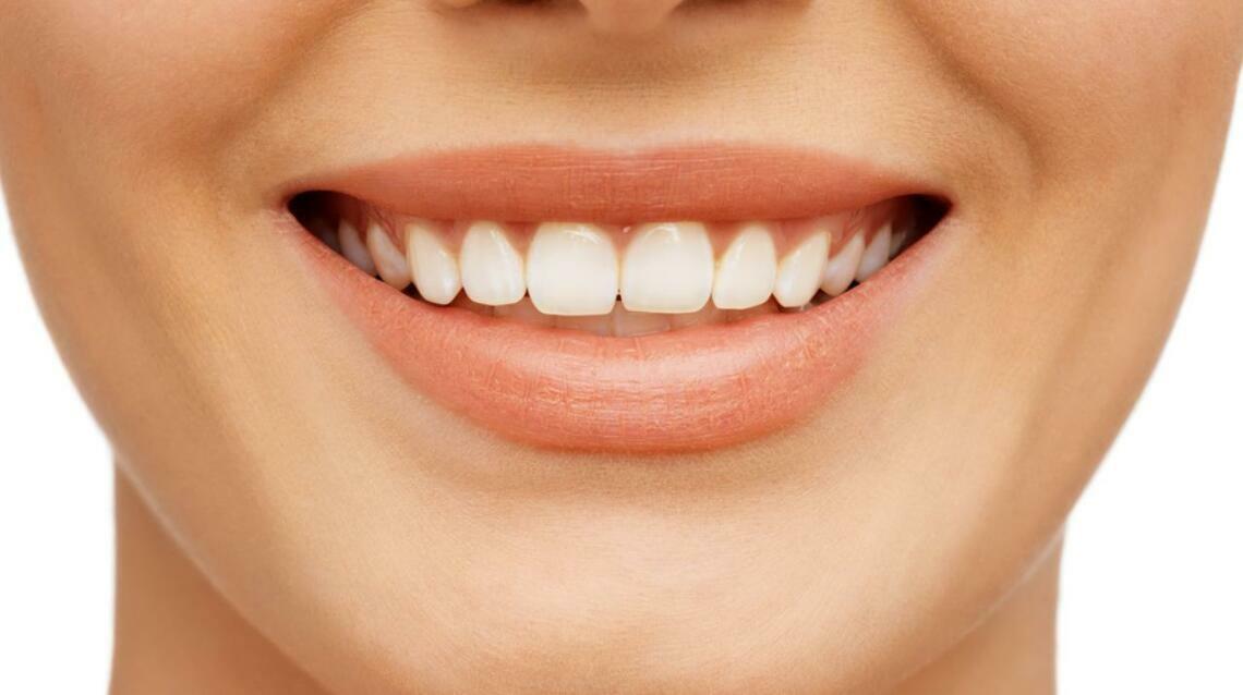 She Wanted a Quick Smile Fix Before a Function