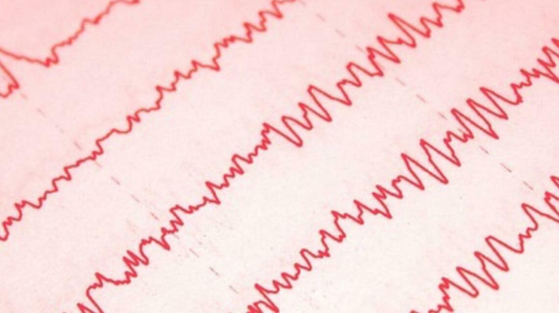 Neurofeedback for Anxiety, Trauma and Ptsd: How It Works