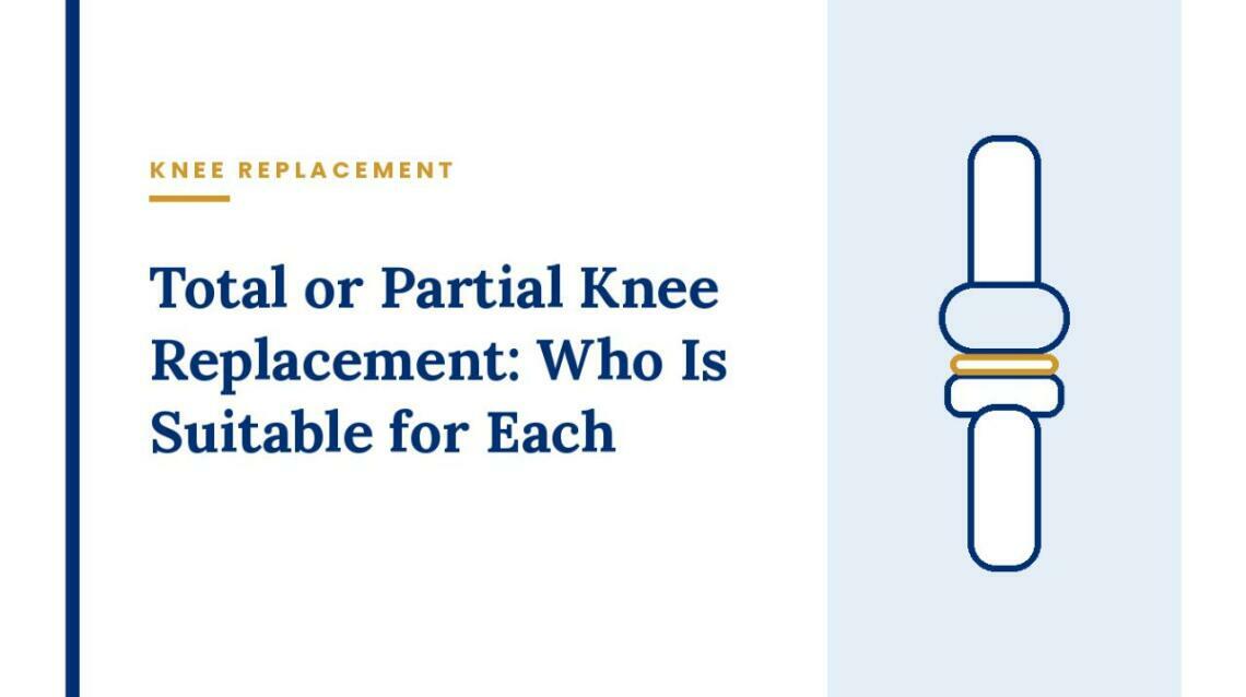 Total or Partial Knee Replacement: Who Is Suitable for Each