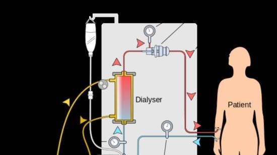 What to Look for in Blood Tests for Patients on Dialysis