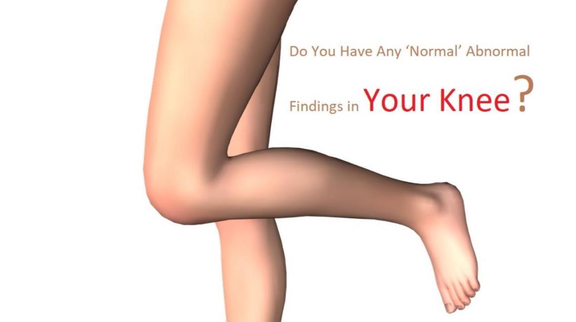Do You Have Any ‘Normal’ Abnormal Findings in Your Knee?