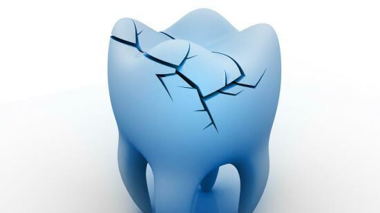 Why You Still Have Pain After Root Canal Treatment