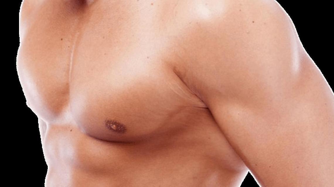 Gynecomastia Surgery in Delhi