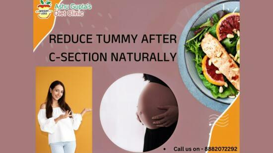 How to Reduce Tummy After C-Section Naturally