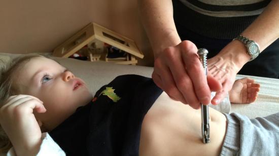 Pranic Acupuncture Will Help Children With Autism