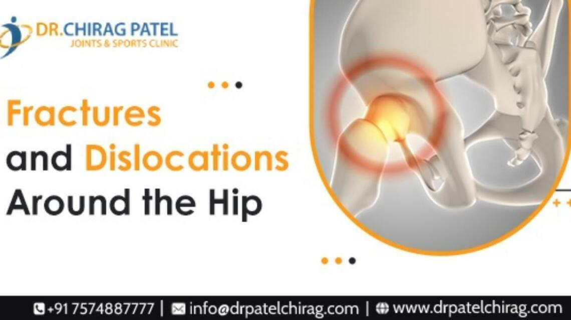Fractures and Dislocations Around the Hip Types, Treatment, and Prevention