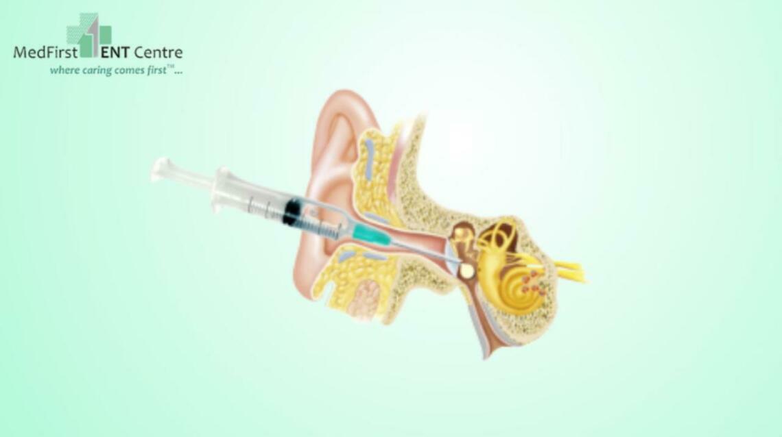 An Injection in the Ear - Intra Tympanic Injection