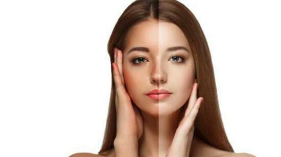 Pigmentation and Tanning :Cause and Prevention
