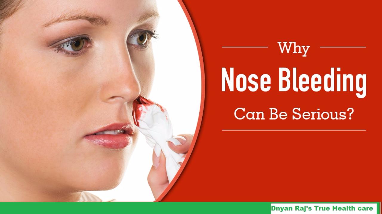 Don t Make Nose Bleeding Common Though It s summer