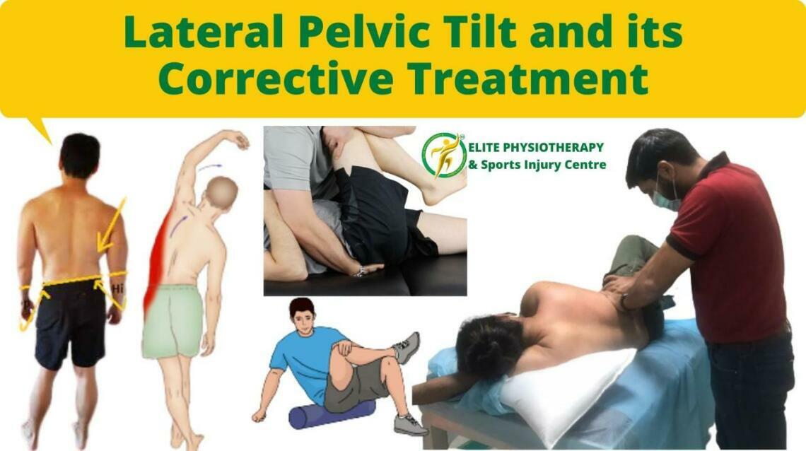 Lateral Pelvic Tilt and Its Corrective Treatment