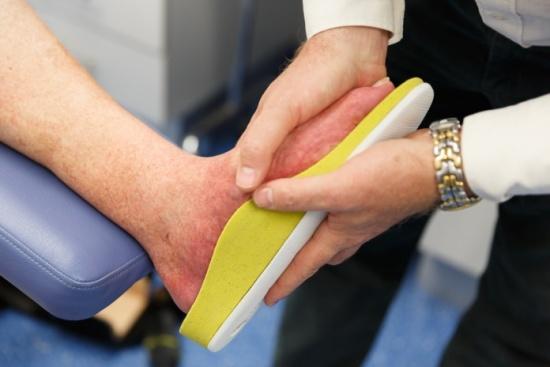 Customised Orthotics for Charcot Foot