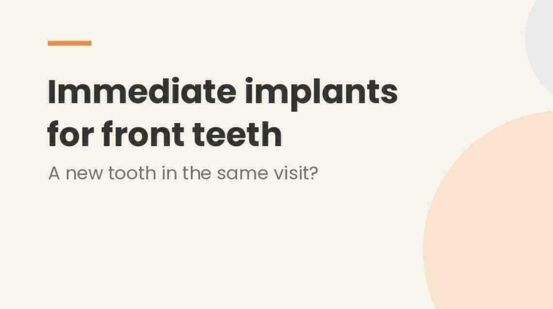 Immediate Implants for Front Teeth: Can You Get a New Tooth the Same Day?