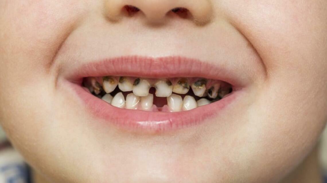 Her Child Was Scared of the Dentist