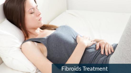 Embolisation - Non Surgical Treatment for Fibroids