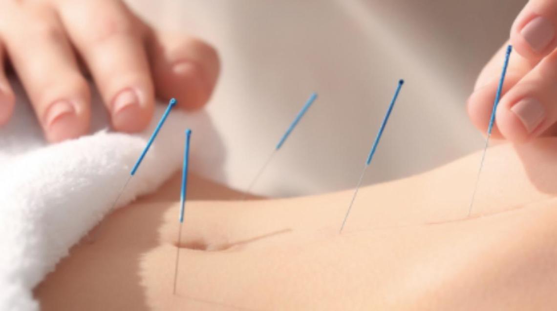 Acupuncture Is the Best Medicine for Chronic Disorders