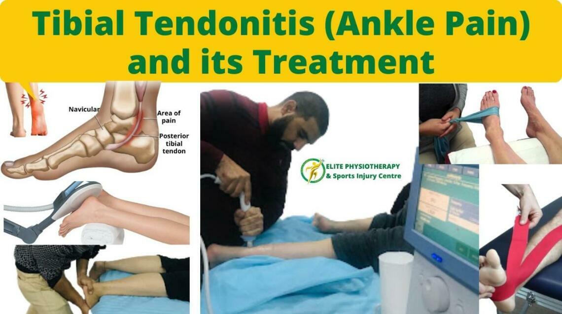 Tibial Tendonitis (Ankle Pain) and Its Treatment