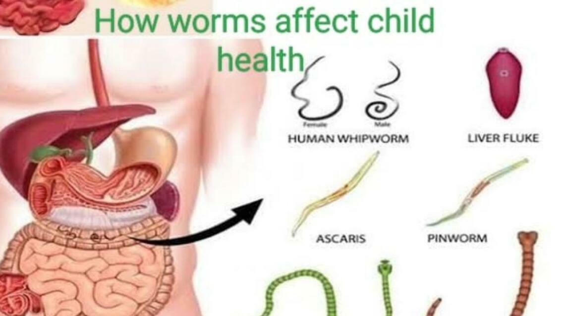 How Do Worm Infections Harm Your Child Gut Health??