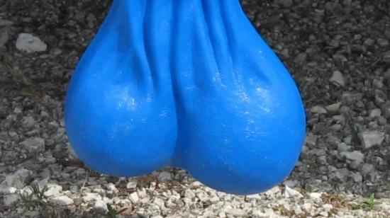 Pain in Testis Post Masturbation